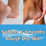 Masterplast Heel Balm (70g For Dry Cracked Heels)